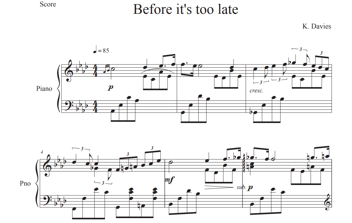 Before Its Too Late - MusicalBasics